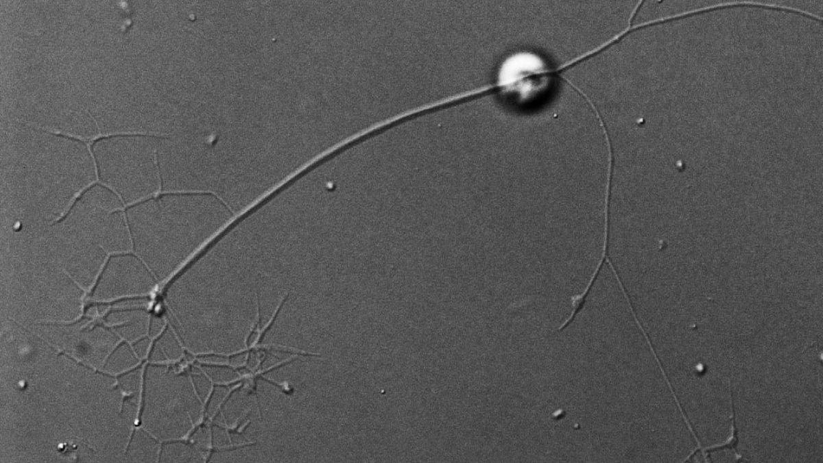 Kraken carinae ist unter einem Lichtmikroskop zu sehen. Abgebildet sind der Zellkörper und Fangfäden