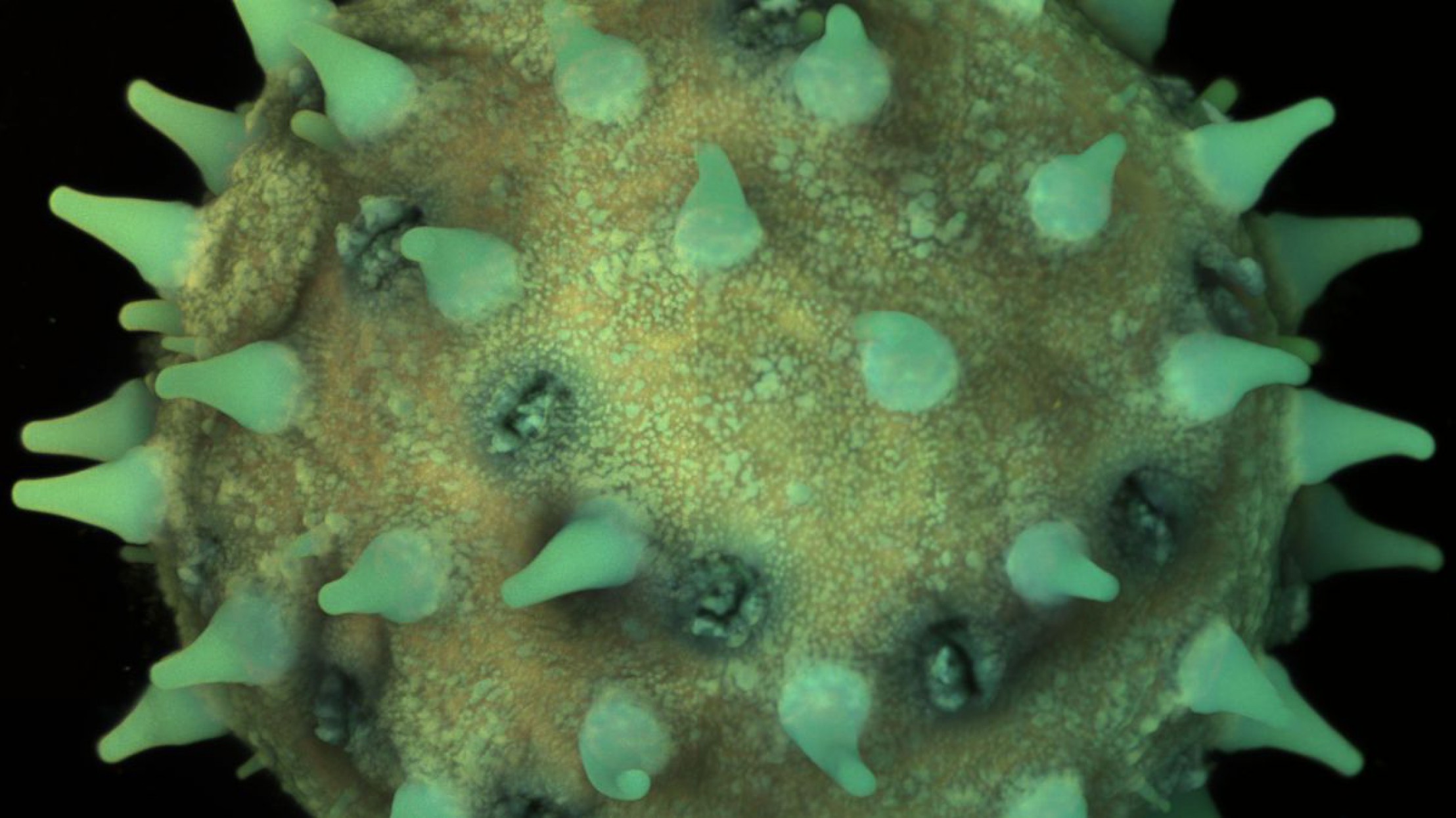 Pollenkorn des Hibiskus unter dem Mikroskop