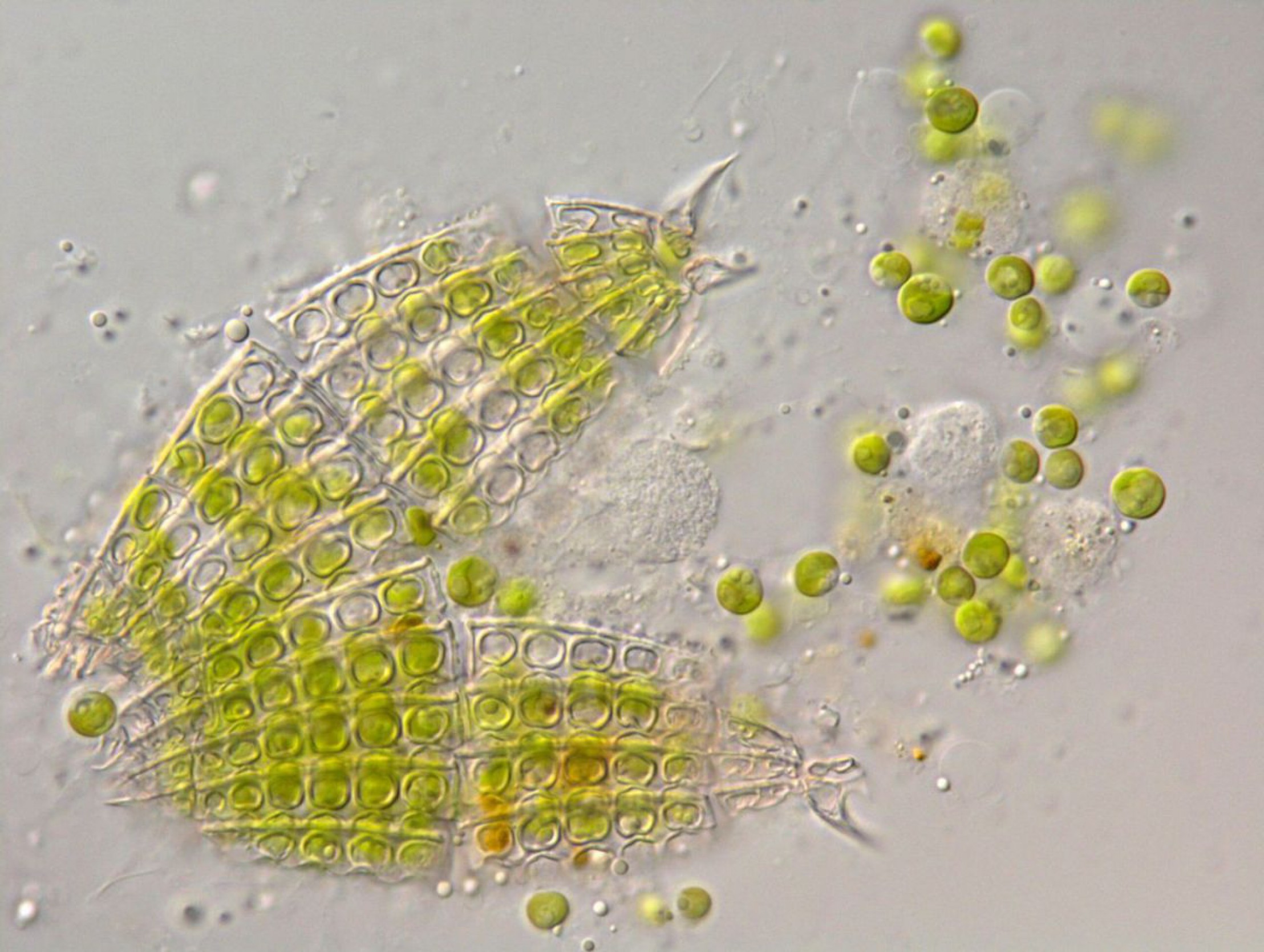 endosymbionten bei coleps