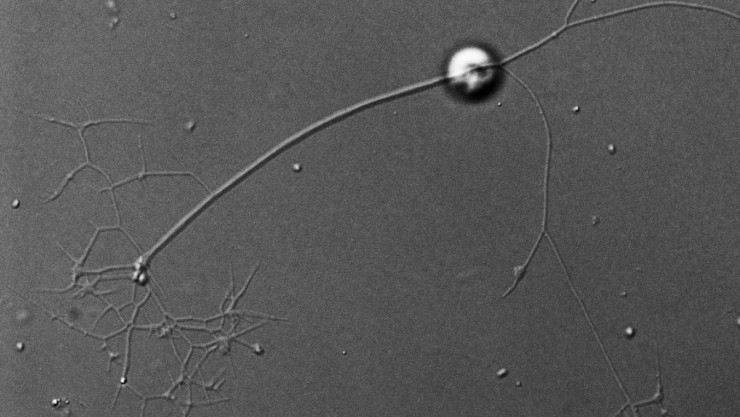 Kraken carinae ist unter einem Lichtmikroskop zu sehen. Abgebildet sind der Zellk&ouml;rper und Fangf&auml;den